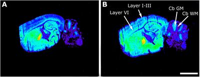 CB1 and LPA1 Receptors Relationship in the Mouse Central Nervous System